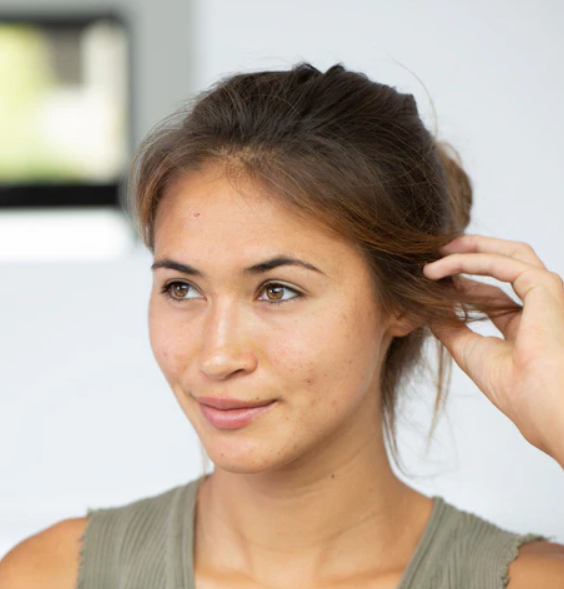 5 Reasons Your Acne Won’t Go Away