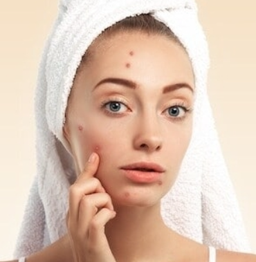 Effective Skin Care Tips for Managing Pigmentation